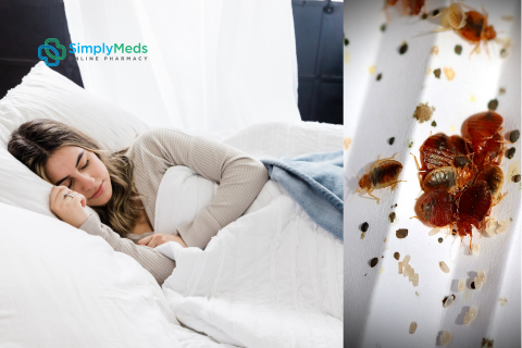 Bedbugs UK – How Do You Know If You Have Bed Bugs and How to Treat Them
