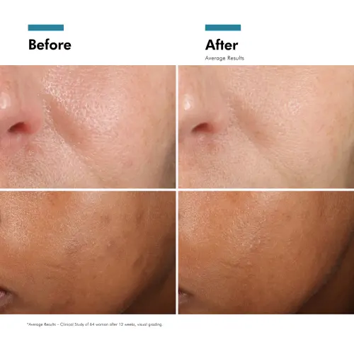 SkinCeuticals Phloretin CF 30ml - Skin lab parent