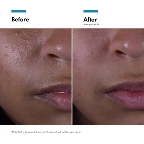 SkinCeuticals Silymarin CF 30ml - Skin lab parent