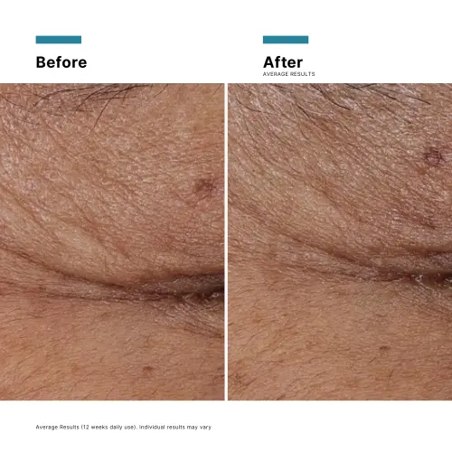 SkinCeuticals P-Tiox 30ml - Skin lab parent