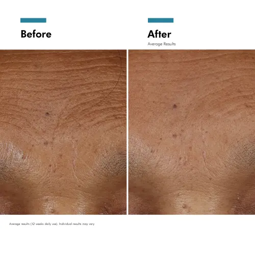 SkinCeuticals HA Intensifier Multi Glycan Serum 30ml - Skin lab parent