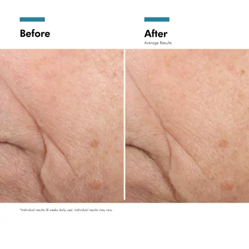 SkinCeuticals Triple Lipid Restore 2:4:2 48ml - Skin lab parent