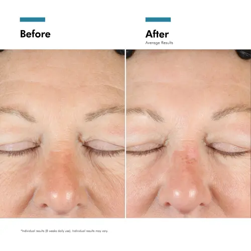 SkinCeuticals A.G.E. Interrupter Advanced 48ml - Skin lab parent